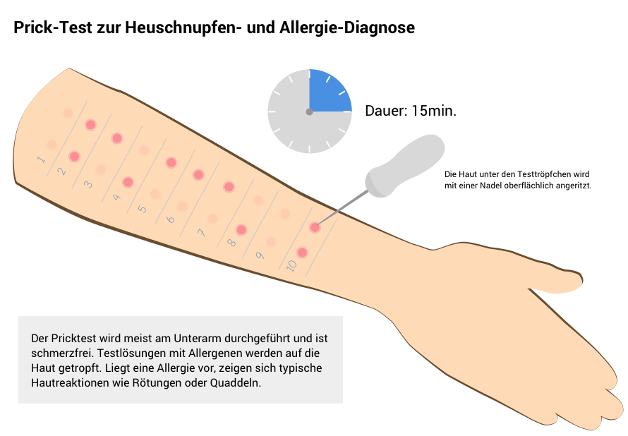 Ablauf des Prick-Tests zur Bestimmung von Allergenen