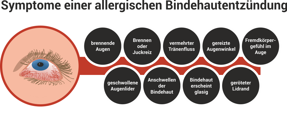 Allergische Bindehautentzundung Hilfe Bei Juckreiz Brennen Altmark Apotheke Stendal Allergische Bindehautentzundung Hilfe Bei Juckreiz Brennen Altmark Apotheke Stendal