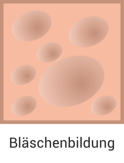 Bläschenbildung