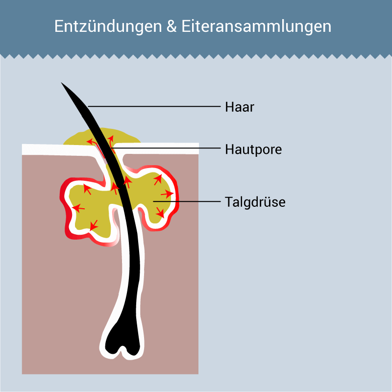 Isotretinoin salbe kaufen