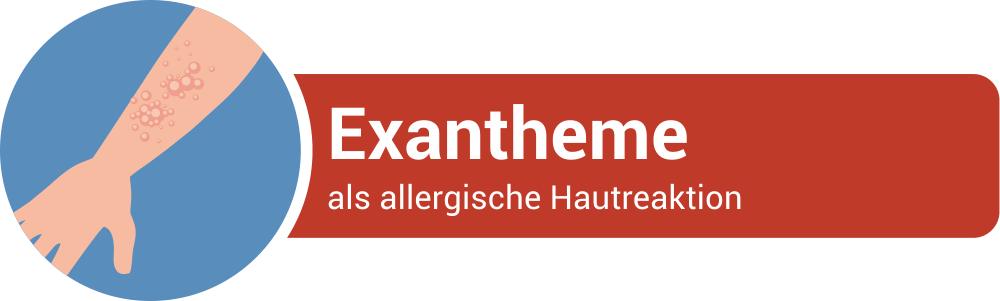 Exantheme als allergische Hautreaktion