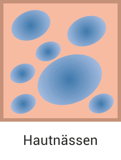 Hautnässen