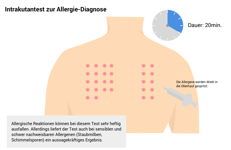 Allergie Heuschnupfen Hilfe Im Ratgeber Altmark Apotheke Stendal Allergie Heuschnupfen Hilfe Im Ratgeber Altmark Apotheke Stendal