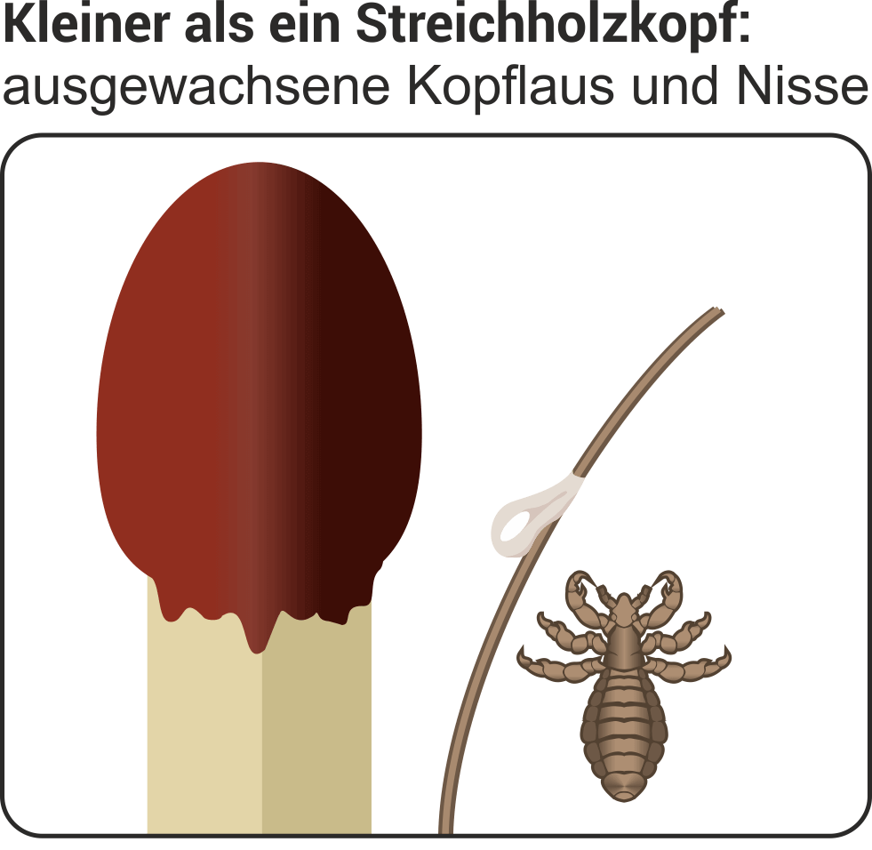 Lause Erkennen Bekampfen Vorbeugen Donn Apotheke St Michaelisdonn Lause Erkennen Bekampfen Vorbeugen Donn Apotheke St Michaelisdonn