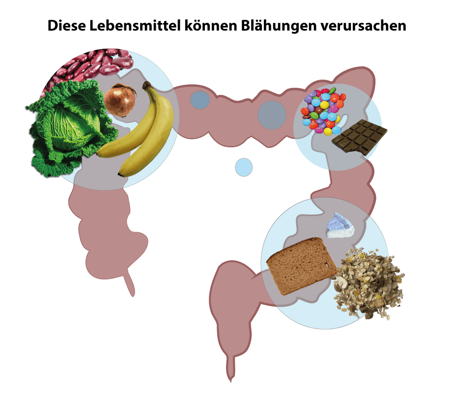 Blähungen | Ernährung, Behandlung & Blähungen bei Babys Kylltal-Apotheke Trier Ehrang