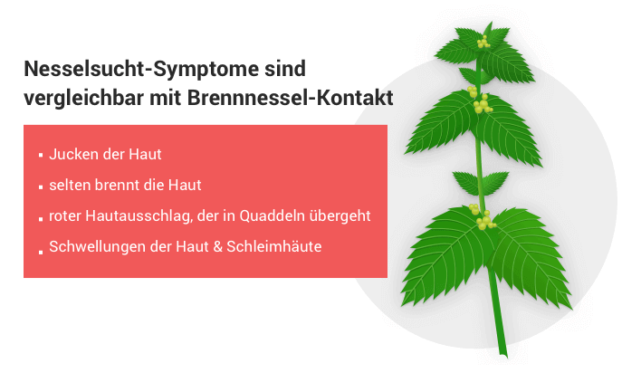 Symptome bei Nesselsucht