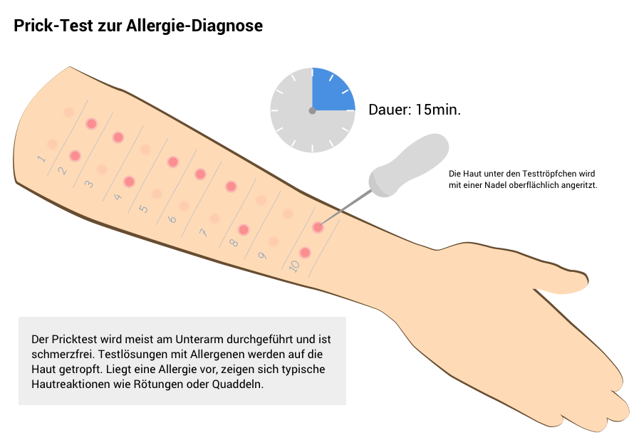 Allergie & Heuschnupfen: Ursachen, Symptome & Behandlung Altmark