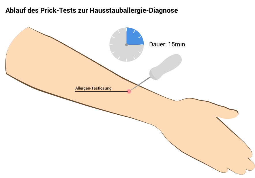 Pricktest zur Diagnose Hausstauballergie