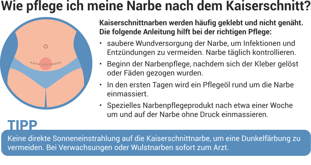 Kaiserschnittnarbe richtig pflegen