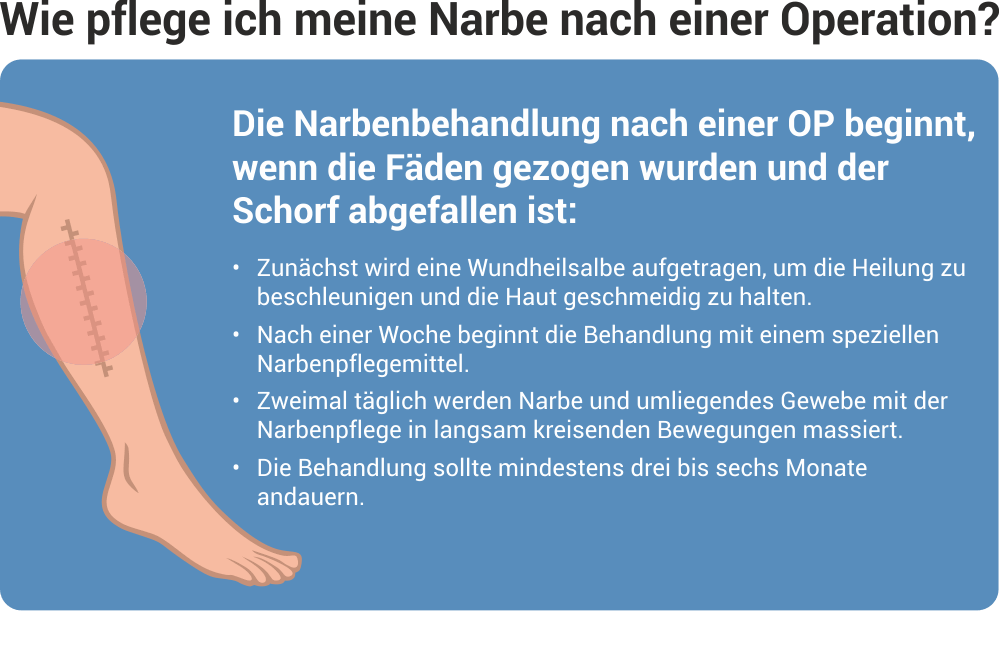 Richtige Narbenpflege OPNarben, Narbe nach Kaiserschnitt, Narbe nach Verbrennung Apotheke am Richtige Narbenpflege OPNarben, Narbe nach Kaiserschnitt, Narbe nach Verbrennung Apotheke am
