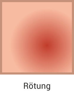 Rötung