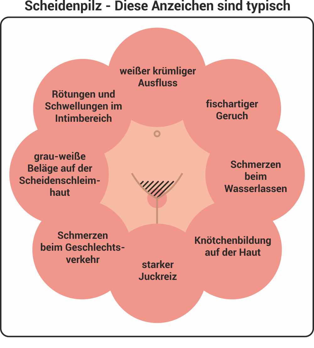 Scheidenpilz Erkennen I Symptome Behandlung Apotheke Am Medizinzentrum Heinsberg Scheidenpilz Erkennen I Symptome Behandlung Apotheke Am Medizinzentrum Heinsberg