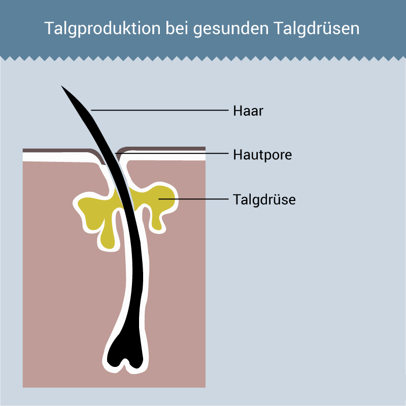 Isotretinoin Rezeptfrei Bestellen