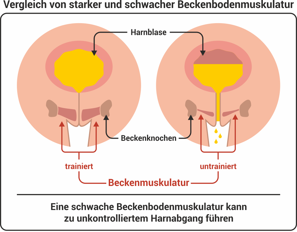Beckenboden stärken mit den richtigen Beckenbodenübungen Markt Apotheke ...