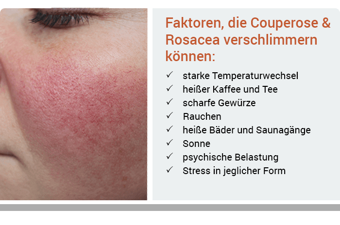 Couperose & Rosacea I Rötungen reduzieren & richtig ernähren Auetal-Apotheke Hanstedt